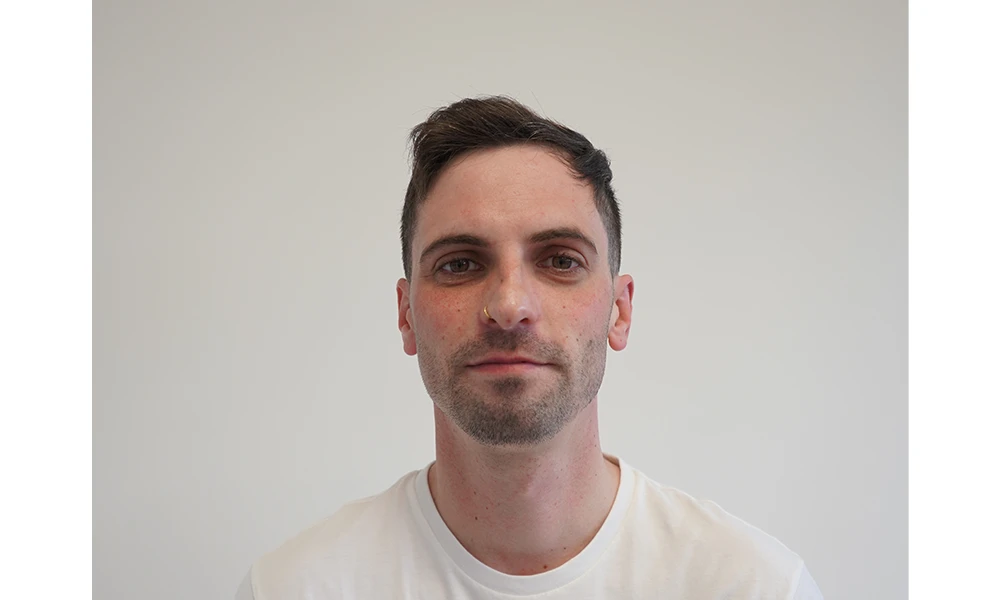 Accounting Case Study Lewis Hughes